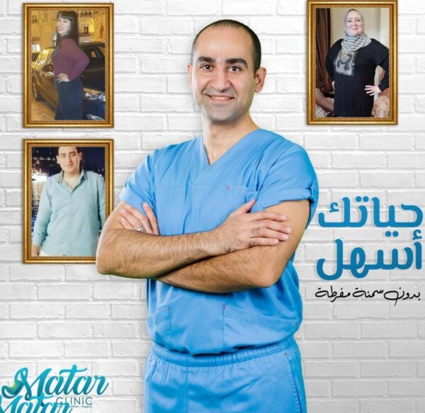 jojo-1 تدبيس المعدة