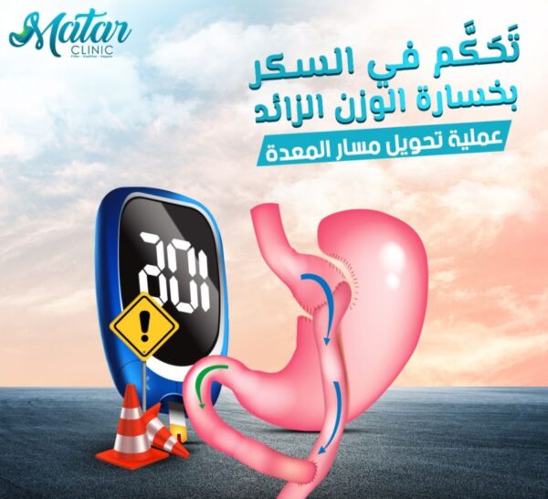 المسار الفرق بين تحويل المسار و تحويل المسار المصغر