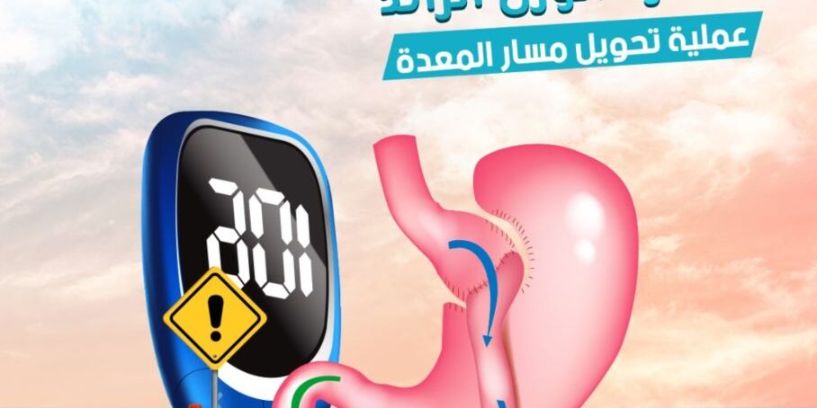 المسار الفرق بين تحويل المسار و تحويل المسار المصغر