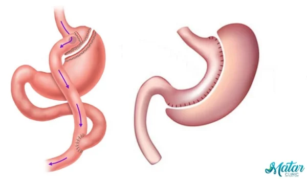 عملية الساسي عملية الساسي