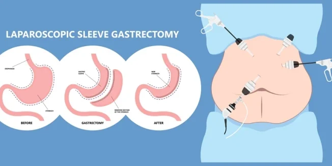 الدباسة الذكية