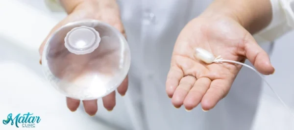 تجربتي مع بالون المعدة تجربتي مع بالون المعدة