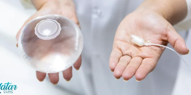 تجربتي مع بالون المعدة تجربتي مع بالون المعدة